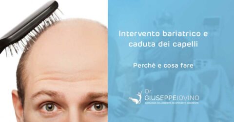 Intervento bariatrico e caduta capelli perché e cosa fare Giuseppe