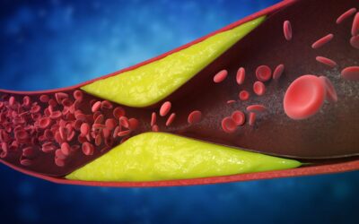 Sindrome metabolica cos’è rischi e cura